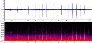 sonogram